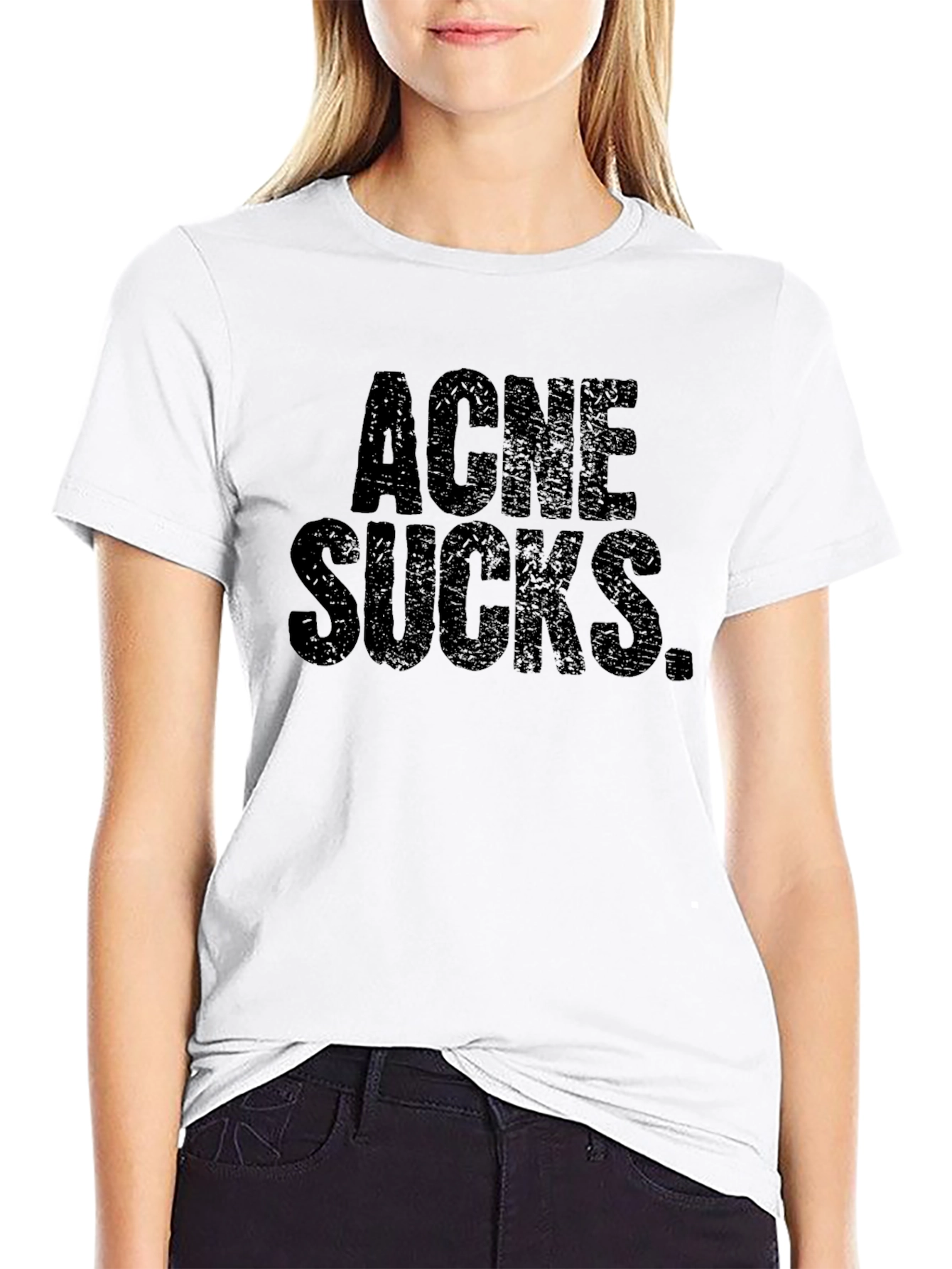 Acne Sucks Black Graphic Tee
