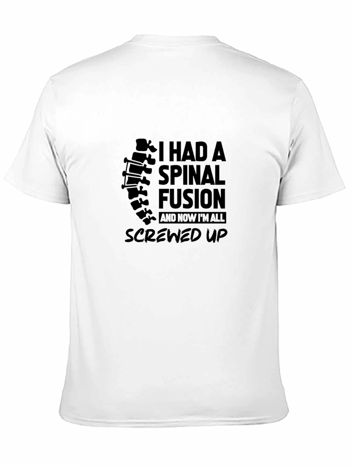 Spinal Fusion T-Shirt - Screw Up Tee